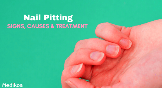 Nail Pitting (Rổ móng tay): Khái niệm, triệu chứng và cách điều trị.